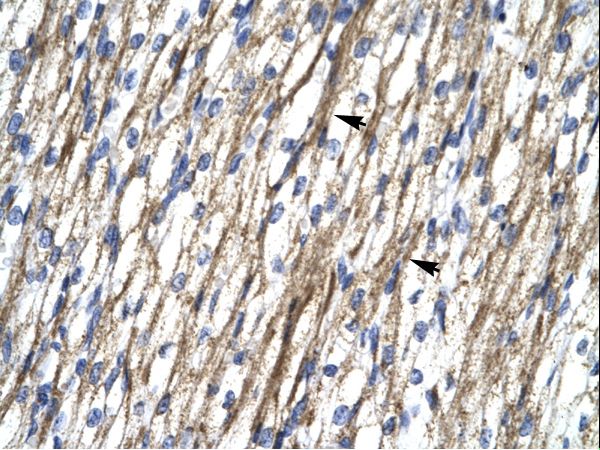 RBM10 antibody LS-C31457 was used in IHC to stain formalin-fixed, paraffin-embedded human heart.
