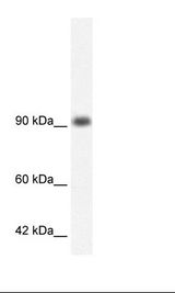 Daudi Cell Lysate