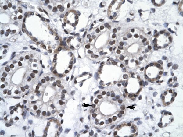RBM10 antibody LS-C31458 was used in IHC to stain formalin-fixed, paraffin-embedded human kidney.