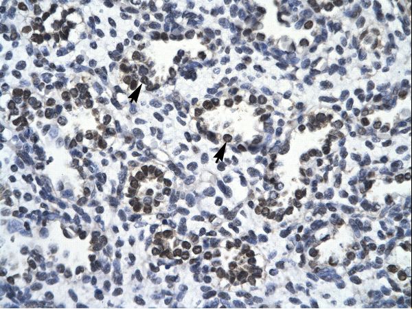 RBM10 antibody LS-C31458 was used in IHC to stain formalin-fixed, paraffin-embedded human lung.