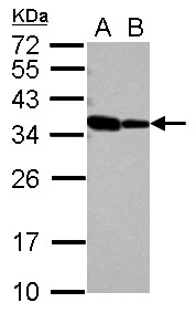 Sample (30 ug of whole cell lysate) A: NT2D1 B: IMR32 12% SDS PAGE RBM11 antibody diluted at 1:1000