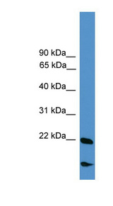RBM18 antibody LS-C116963 Western blot of COLO205 cell lysate.