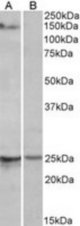 RBM20 antibody (1 ug/ml) staining of Mouse Heart lysate (35 ug protein/ml in RIPA buffer) with (B) and without (A) blocking with the immunizing peptide. Primary incubation was 1 hour. Detected by chemiluminescence.