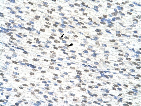 RBM22 antibody LS-C30507 was used in IHC to stain formalin-fixed, paraffin-embedded human heart.