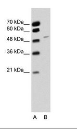 A: Marker, B: Jurkat Cell Lysate