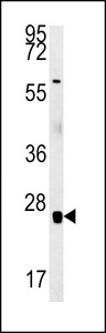 RBM24 Antibody western blot of mouse heart tissue lysates (15 ug/lane). The RBM24 antibody detected RBM24 protein (arrow).