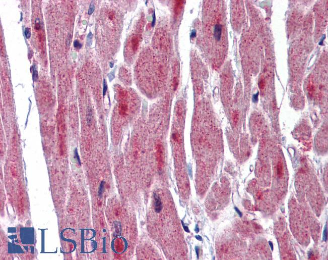 Anti-RBM24 antibody IHC of human heart. Immunohistochemistry of formalin-fixed, paraffin-embedded tissue after heat-induced antigen retrieval. Antibody LS-B5720 concentration 5 ug/ml.