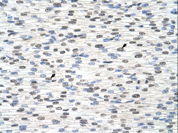 RBM28 antibody LS-C30373 was used in IHC to stain formalin-fixed, paraffin-embedded human heart.