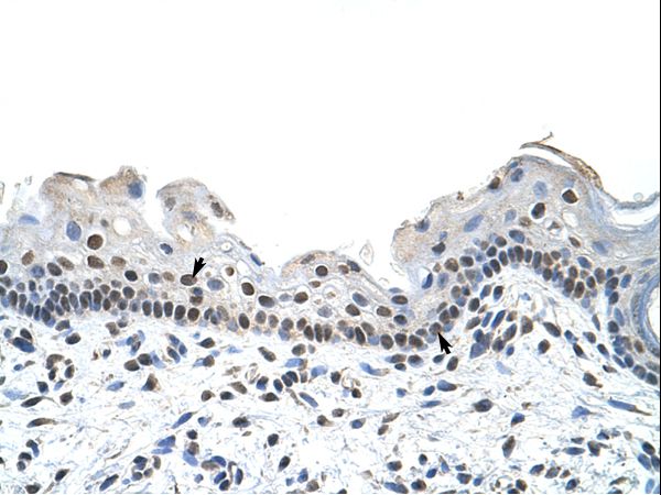 RBM28 antibody LS-C30373 was used in IHC to stain formalin-fixed, paraffin-embedded human skin.