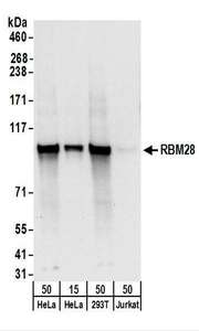 Detection of Human RBM28 by Western Blot. Samples: Whole cell lysate from HeLa (15 and 50 ug), 293T (50 ug), and Jurkat (50 ug) cells. Antibodies: Affinity purified rabbit anti-RBM28 antibody used for WB at 0.1 ug/ml. Detection: Chemiluminescence with an exposure time of 10 seconds.