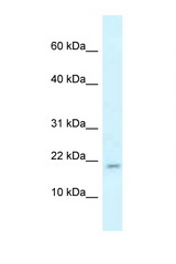 RBM3 antibody LS-C145448 Western blot of Mouse Liver lysate. Antibody concentration 1 ug/ml.