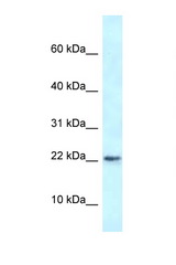 RBM3 antibody LS-C145447 Western blot of Rat Lung lysate. Antibody concentration 1 ug/ml.