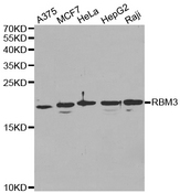 Western blot analysis of extracts of various cell lines, using RBM3 antibody.