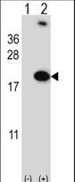 Western blot of RBM3 (arrow) using rabbit polyclonal RBM3 Antibody. 293 cell lysates (2 ug/lane) either nontransfected (Lane 1) or transiently transfected (Lane 2) with the RBM3 gene.