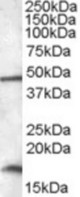 RBM3 antibody (0.01 ug/ml) staining of HepG2 lysate (35 ug protein/ml in RIPA buffer). Primary incubation was 1 hour. Detected by chemiluminescence.