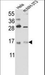 Western blot of RBM3 Antibody in HeLa cell line lysates and mouse NIH-3T3 tissues lysates(35 ug/lane). RBM3 (arrow) was detected using the purified antibody.