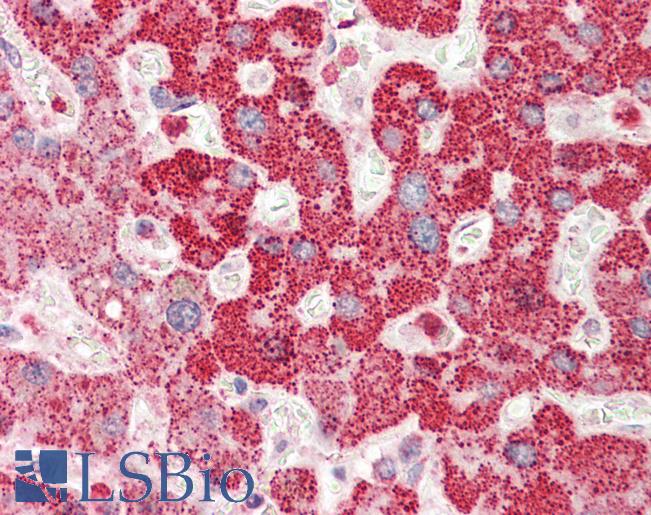Anti-RBM38 antibody IHC staining of human liver. Immunohistochemistry of formalin-fixed, paraffin-embedded tissue after heat-induced antigen retrieval. Antibody LS-B9690 concentration 5 ug/ml.