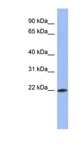 RBM38 antibody LS-C110575 Western blot of HT1080 cell lysate.