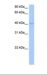 MCF7 cell lysate. Antibody concentration: 0.5 ug/ml. Gel concentration: 12%.