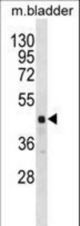 RBM41 Antibody western blot of mouse bladder tissue lysates (35 ug/lane). The RBM41 antibody detected the RBM41 protein (arrow).