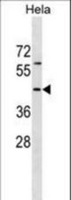 RBM41 Antibody western blot of HeLa cell line lysates (35 ug/lane). The RBM41 antibody detected the RBM41 protein (arrow).