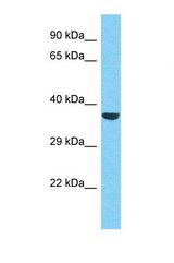 Western blot of Human HepG2. RBM43 antibody dilution 1.0 ug/ml.