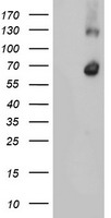 HEK293T cells were transfected with the pCMV6-ENTRY control (Left lane) or pCMV6-ENTRY RBM46 (Right lane) cDNA for 48 hrs and lysed. Equivalent amounts of cell lysates (5 ug per lane) were separated by SDS-PAGE and immunoblotted with anti-RBM46.