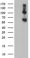 HEK293T cells were transfected with the pCMV6-ENTRY control (Left lane) or pCMV6-ENTRY RBM46 (Right lane) cDNA for 48 hrs and lysed. Equivalent amounts of cell lysates (5 ug per lane) were separated by SDS-PAGE and immunoblotted with anti-RBM46.