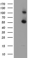 HEK293T cells were transfected with the pCMV6-ENTRY control (Left lane) or pCMV6-ENTRY RBM46 (Right lane) cDNA for 48 hrs and lysed. Equivalent amounts of cell lysates (5 ug per lane) were separated by SDS-PAGE and immunoblotted with anti-RBM46.