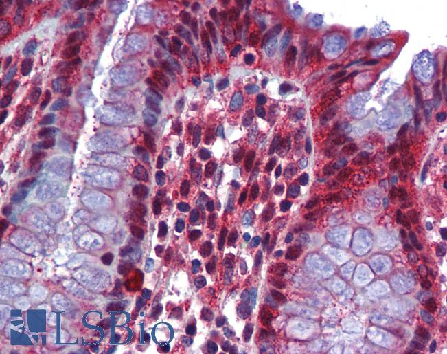 Anti-RBM47 antibody IHC of human colon. Immunohistochemistry of formalin-fixed, paraffin-embedded tissue after heat-induced antigen retrieval. Antibody LS-B5717 concentration 5 ug/ml.