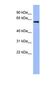 RBM47 antibody LS-B5717 Western blot of NCI-H226 cell lysate.