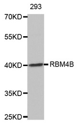 Western blot analysis of extracts of 293 cell lines, using RBM4B antibody.