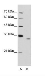 A: Marker, B: Jurkat Cell Lysate