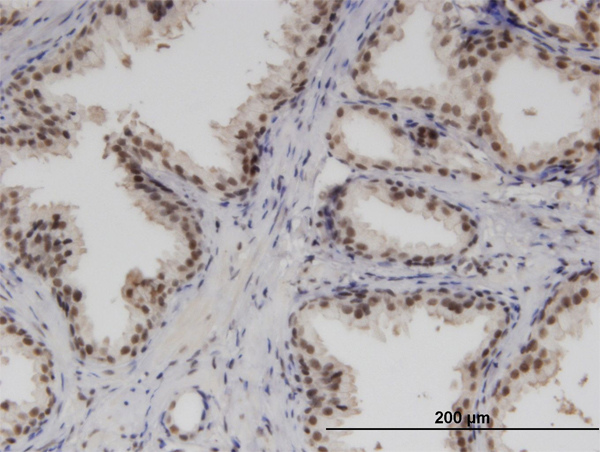 Immunoperoxidase of monoclonal antibody to RBM6 on formalin-fixed paraffin-embedded human prostate. [antibody concentration 3 ug/ml]