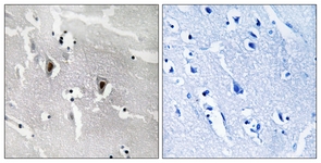 IHC of paraffin-embedded human brain tissue, using RBM6 Antibody. The sample on the right was incubated with synthetic peptide.