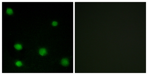 Immunofluorescence of COS7 cells, using RBM6 Antibody. The sample on the right was incubated with synthetic peptide.