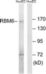 Western blot of extracts from HUVEC cells, using RBM6 Antibody. The lane on the right was incubated with synthetic peptide.