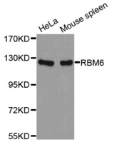 Western blot analysis of extracts of various cell lines, using RBM6 antibody.