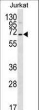 PSAPL1 Antibody western blot of Jurkat cell line lysates (35 ug/lane). The PSAPL1 antibody detected the PSAPL1 protein (arrow).
