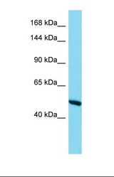 Western blot of Human Thymus Tumor. RBM6 antibody dilution 1.0 ug/ml.