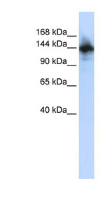 RBM6 antibody LS-C101342 Western blot of HepG2 cell lysate.