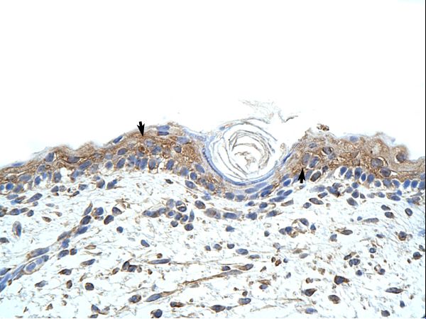 RBMS1 antibody LS-C31610 was used in IHC to stain formalin-fixed, paraffin-embedded human skin.