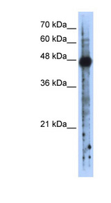 RBMS2 antibody LS-C110516 Western blot of Transfected 293T cell lysate.
