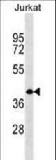 RBMS2 Antibody western blot of Jurkat cell line lysates (35 ug/lane). The RBMS2 antibody detected the RBMS2 protein (arrow).