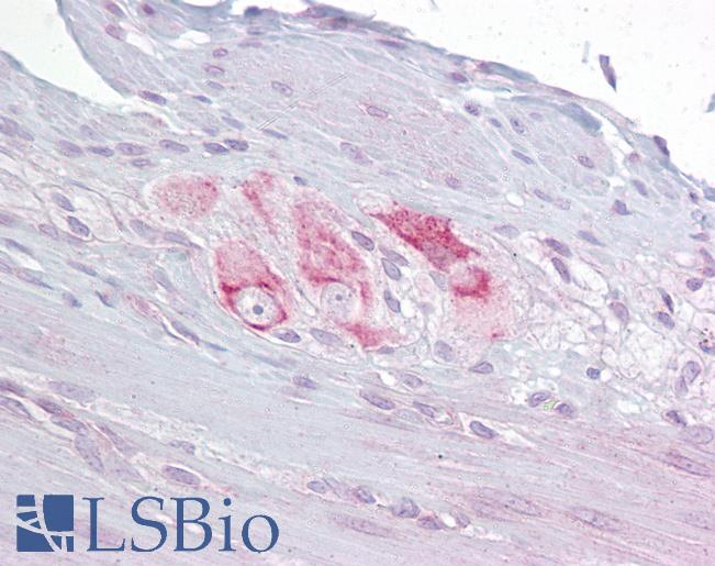 Anti-RBMS3 antibody IHC of human small intestine, myenteric plexus. Immunohistochemistry of formalin-fixed, paraffin-embedded tissue after heat-induced antigen retrieval. Antibody LS-B6816 concentration 10 ug/ml.
