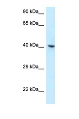 RBMX antibody LS-C145669 Western blot of 3 Cell lysate. Antibody concentration 1 ug/ml.