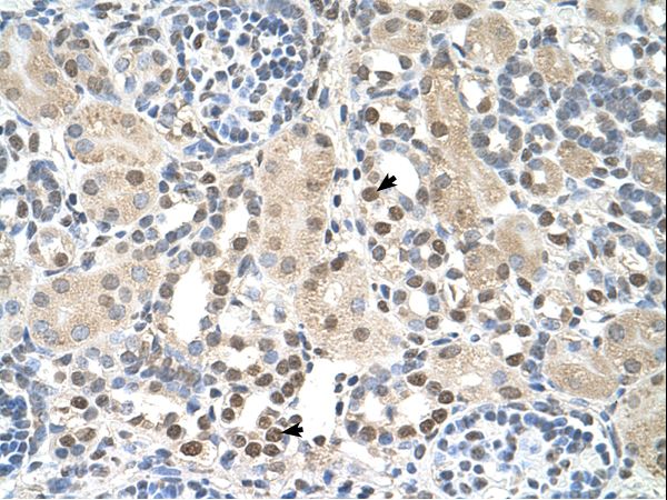 PSAT1 antibody LS-C80875 was used in IHC to stain formalin-fixed, paraffin-embedded human kidney.