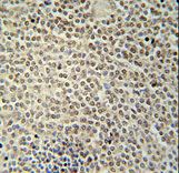 RBMX2 Antibody immunohistochemistry of formalin-fixed and paraffin-embedded human spleen tissue followed by peroxidase-conjugated secondary antibody and DAB staining.