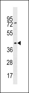 RBMXL1 Antibody western blot of HepG2 cell line lysates (35 ug/lane). The RBMXL1 antibody detected the RBMXL1 protein (arrow).
