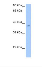 Liver cell lysate. Antibody concentration: 0.5 ug/ml. Gel concentration: 12%.